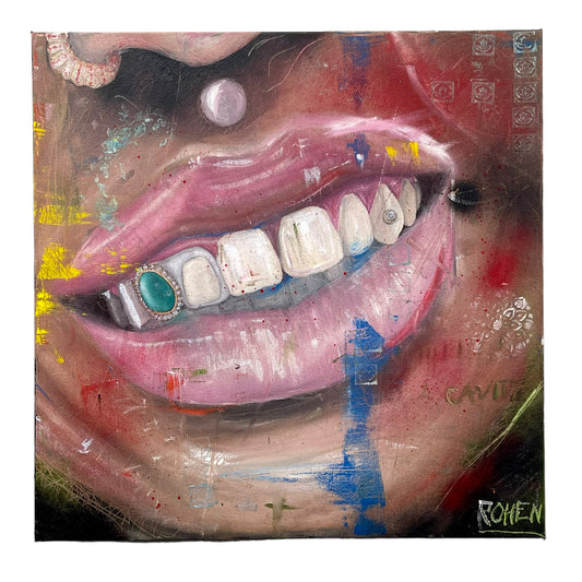 Chompers
